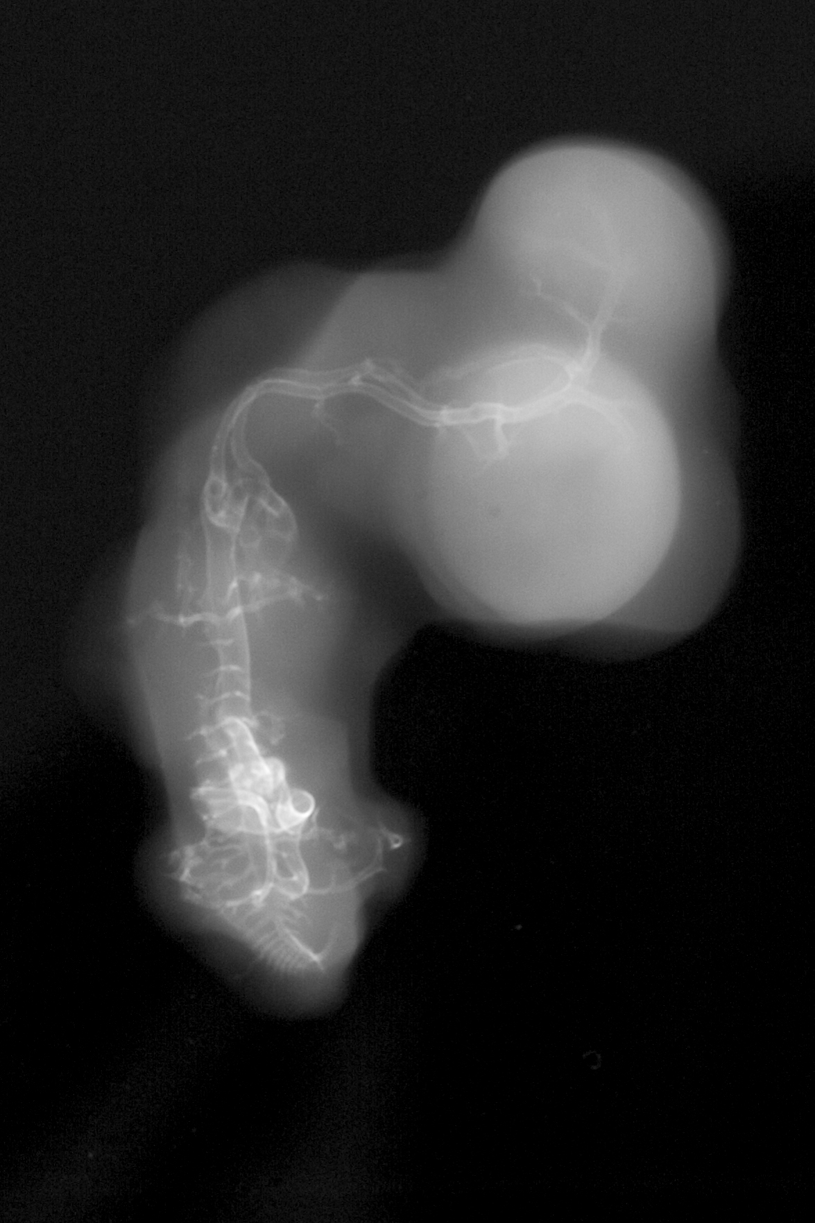 stage 28 chick embryo x-ray